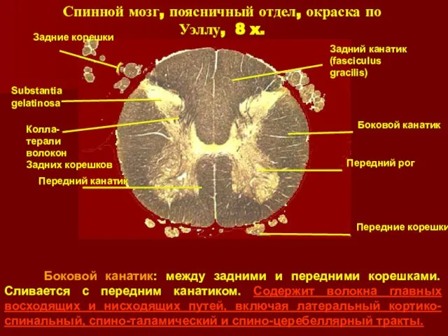 Спинной мозг, поясничный отдел, окраска по Уэллу, 8 x. Боковой канатик: между
