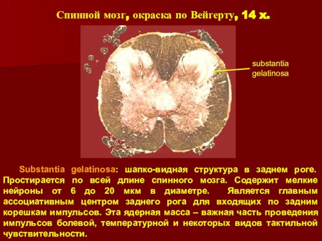 Спинной мозг, окраска по Вейгерту, 14 x. Substantia gelatinosa: шапко-видная структура в