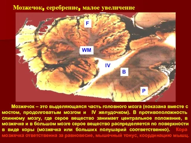 Мозжечок, серебрение, малое увеличение Мозжечок – это выделяющаяся часть головного мозга (показана