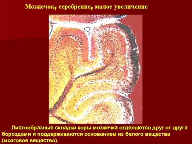 Мозжечок, серебрение, малое увеличение Листообразные складки коры мозжечка отделяются друг от друга