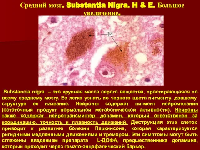 Средний мозг. Substantia Nigra. H & E. Большое увеличение. Substancia nigra –