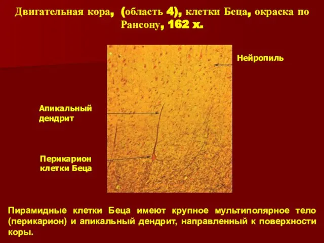 Двигательная кора, (область 4), клетки Беца, окраска по Рансону, 162 x. Пирамидные