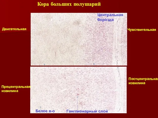 Кора больших полушарий