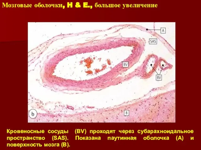 Мозговые оболочки, H & E., большое увеличение Кровеносные сосуды (BV) проходят через