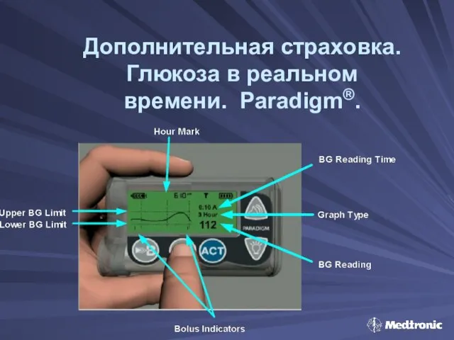 Дополнительная страховка. Глюкоза в реальном времени. Paradigm®.