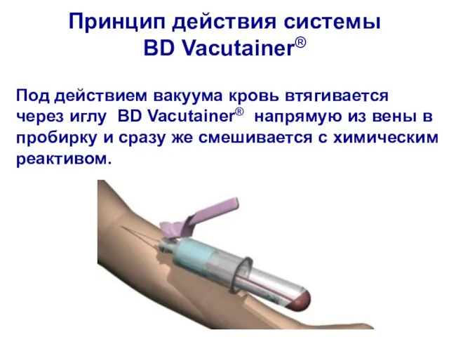 Под действием вакуума кровь втягивается через иглу BD Vacutainer® напрямую из вены