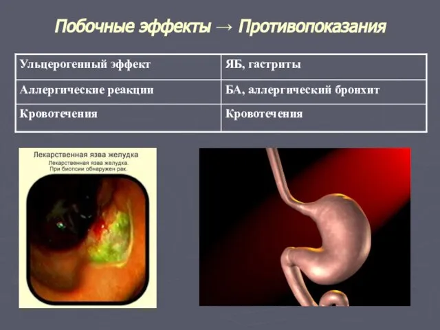 Побочные эффекты → Противопоказания