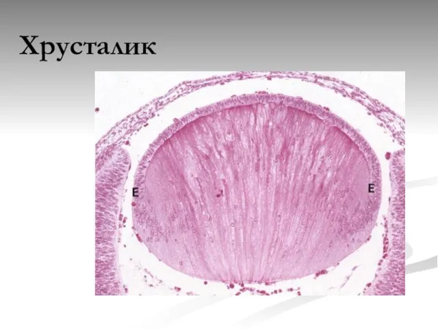 Хрусталик