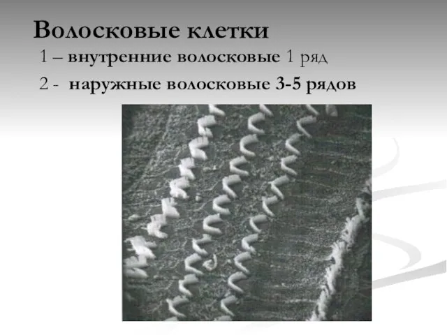 Волосковые клетки 1 – внутренние волосковые 1 ряд 2 - наружные волосковые 3-5 рядов