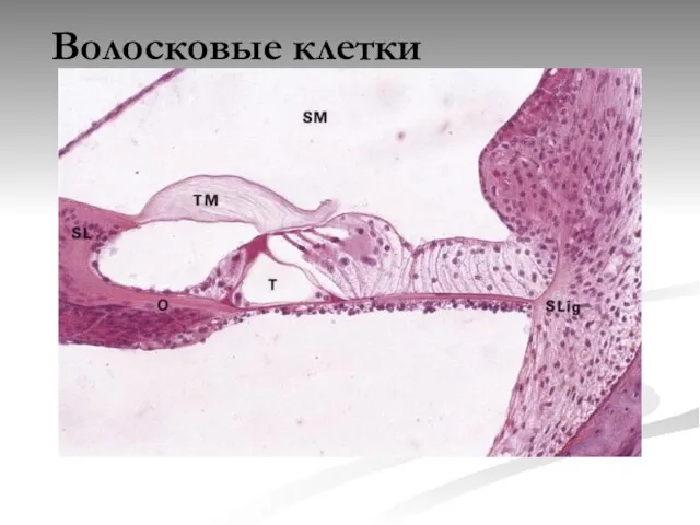 Волосковые клетки