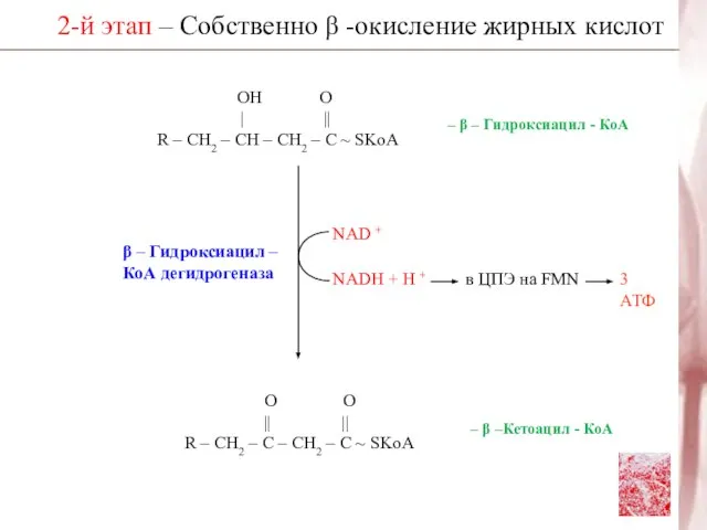 2-й этап – Собственно β -окисление жирных кислот β – Гидроксиацил –