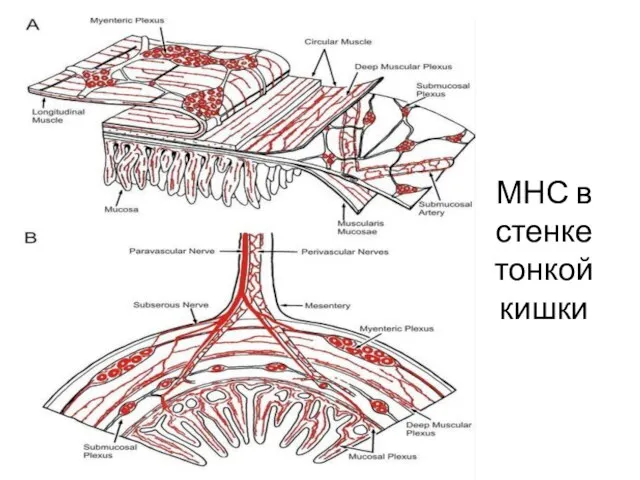 МНС в стенке тонкой кишки