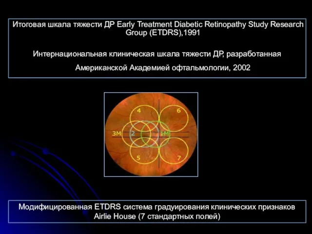 Итоговая шкала тяжести ДР Early Treatment Diabetic Retinopathy Study Research Group (ETDRS),1991