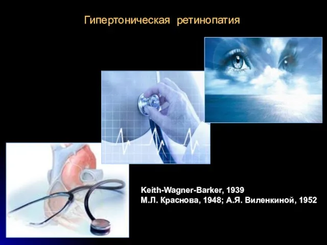 Гипертоническая ретинопатия Keith-Wagner-Barker, 1939 М.Л. Краснова, 1948; А.Я. Виленкиной, 1952