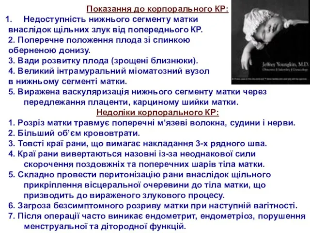 Показання до корпорального КР: Недоступність нижнього сегменту матки внаслідок щільних злук від