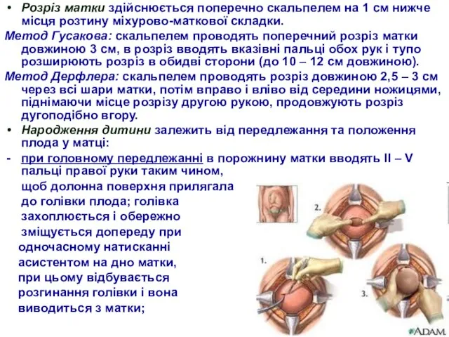 Розріз матки здійснюється поперечно скальпелем на 1 см нижче місця розтину міхурово-маткової