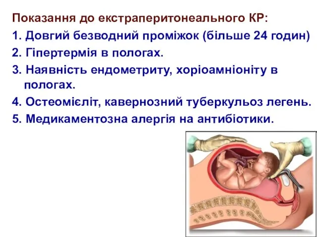 Показання до екстраперитонеального КР: 1. Довгий безводний проміжок (більше 24 годин) 2.