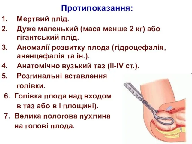 Протипоказання: Мертвий плід. Дуже маленький (маса менше 2 кг) або гігантський плід.