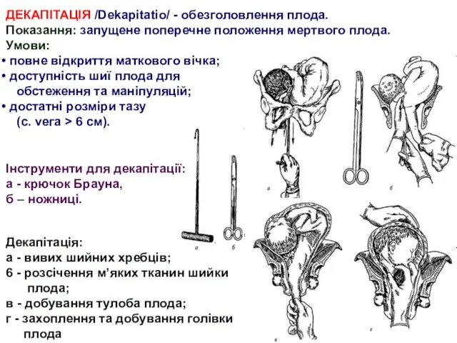 Декапітація: а - вивих шийних хребців; 6 - розсічення м’яких тканин шийки