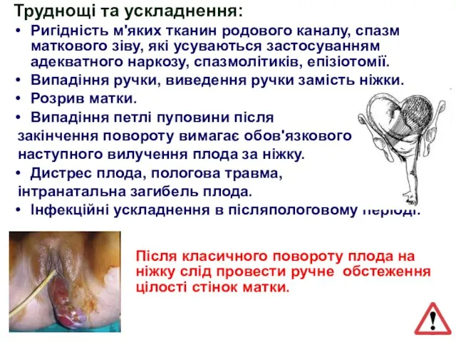 Труднощі та ускладнення: Ригідність м'яких тканин родового каналу, спазм маткового зіву, які