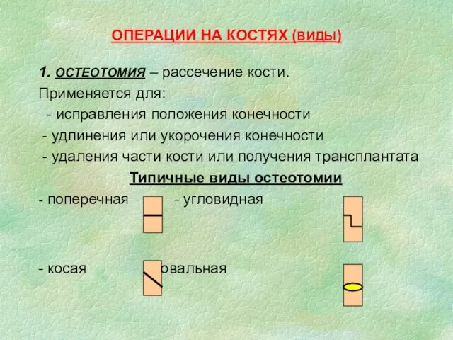 ОПЕРАЦИИ НА КОСТЯХ (ВИДЫ) 1. ОСТЕОТОМИЯ – рассечение кости. Применяется для: -