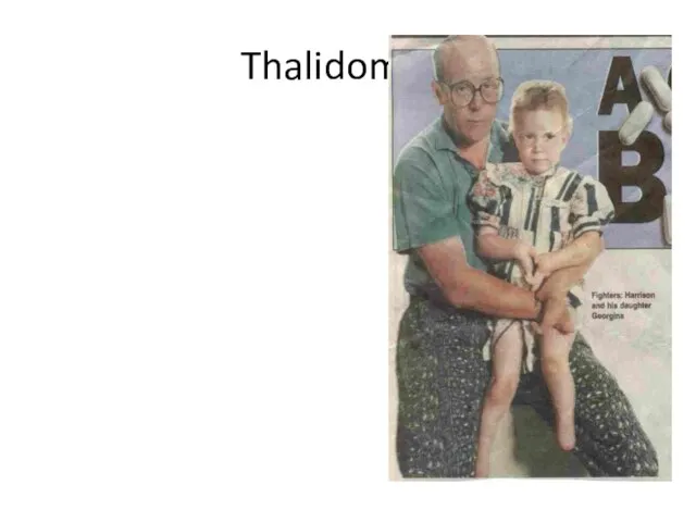 Thalidomide Early 1960’s given to pregnant women to treat morning sickness Later