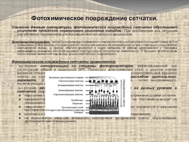 Фотохимическое повреждение сетчатки. Согласно данным литературы, фотохимическое повреждение сетчатки обусловлено усилением процессов