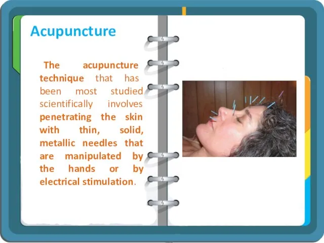 Acupuncture The acupuncture technique that has been most studied scientifically involves penetrating