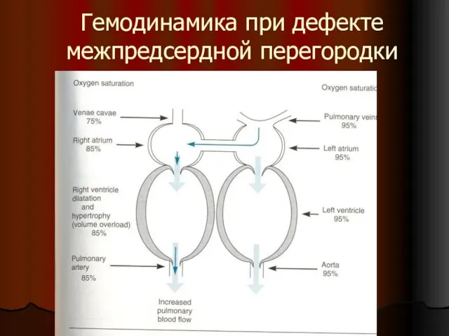 Гемодинамика при дефекте межпредсердной перегородки