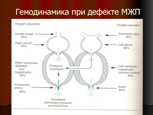 Гемодинамика при дефекте МЖП