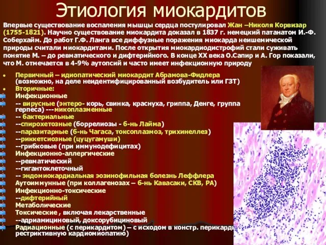 Этиология миокардитов Первичный – идиопатический миокардит Абрамова-Фидлера (возможно, на деле неидентифицированный возбудитель