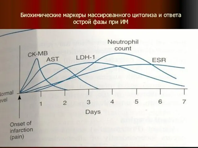 Биохимические маркеры массированного цитолиза и ответа острой фазы при ИМ