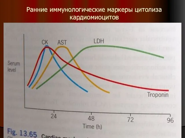 Ранние иммунологические маркеры цитолиза кардиомиоцитов