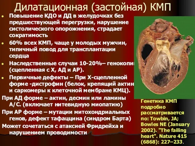 Дилатационная (застойная) КМП Повышение КДО и ДД в желудочках без предшествующей перегрузки,