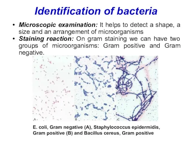 Identification of bacteria Microscopic examination: It helps to detect a shape, a