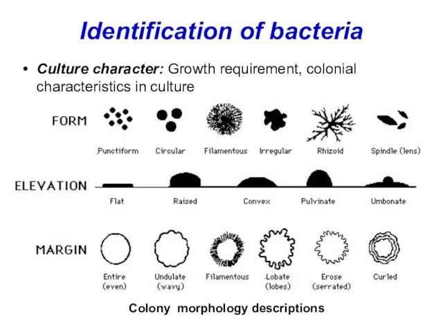 Identification of bacteria Culture character: Growth requirement, colonial characteristics in culture Colony morphology descriptions