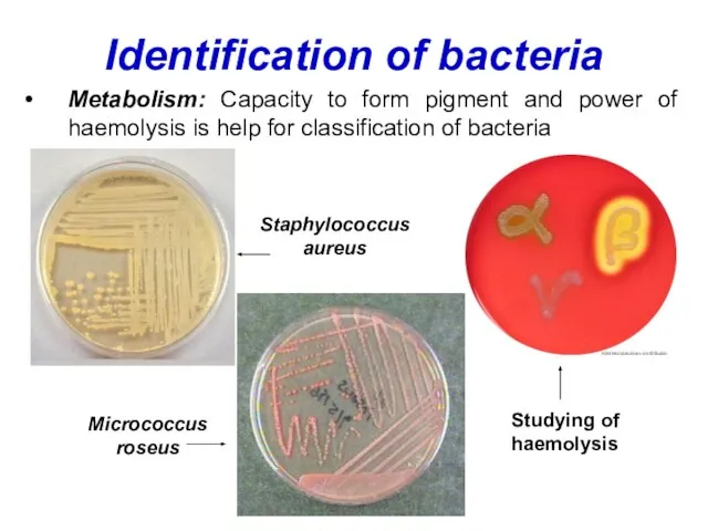 Identification of bacteria Metabolism: Capacity to form pigment and power of haemolysis