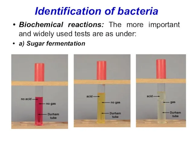 Identification of bacteria Biochemical reactions: The more important and widely used tests