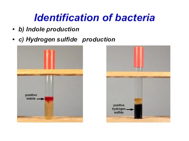 Identification of bacteria b) Indole production c) Hydrogen sulfide production