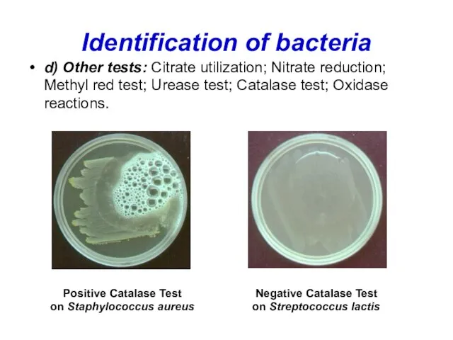 Identification of bacteria d) Other tests: Citrate utilization; Nitrate reduction; Methyl red