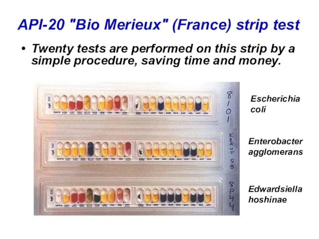 API-20 "Bio Merieux" (France) strip test Twenty tests are performed on this