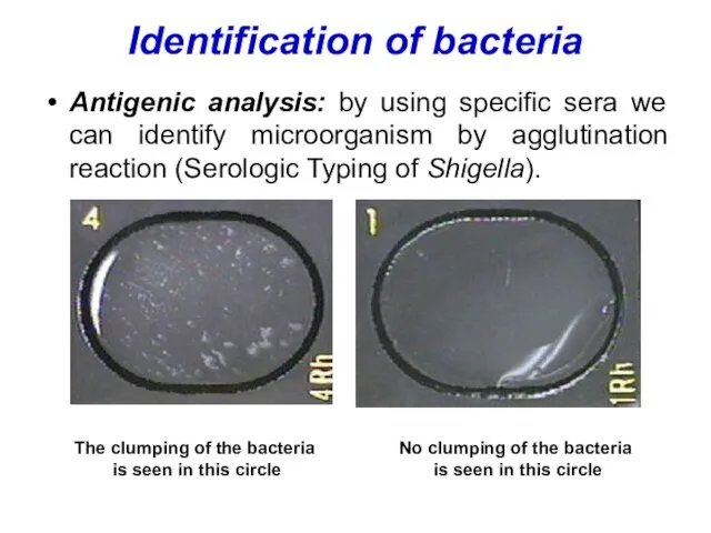Identification of bacteria Antigenic analysis: by using specific sera we can identify