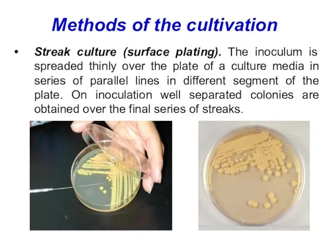 Methods of the cultivation Streak culture (surface plating). The inoculum is spreaded