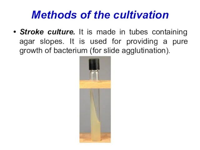 Methods of the cultivation Stroke culture. It is made in tubes containing