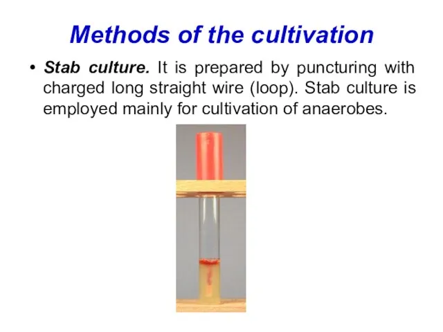Methods of the cultivation Stab culture. It is prepared by puncturing with
