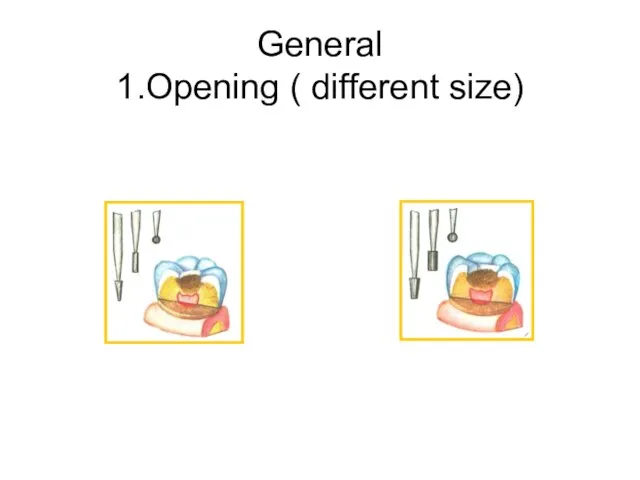 General 1.Opening ( different size)