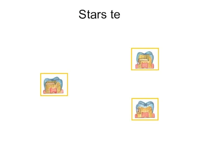 Stars te