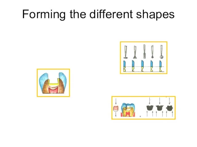 Forming the different shapes