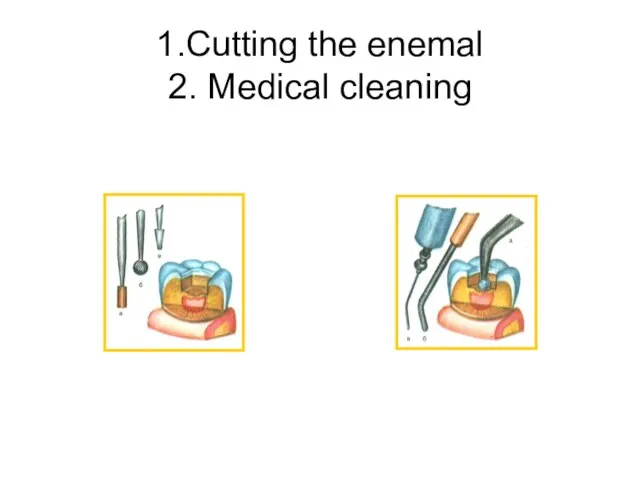 1.Cutting the enemal 2. Medical cleaning