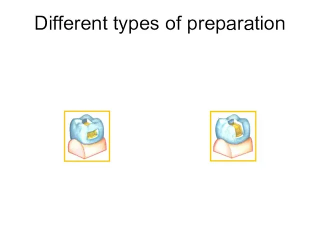 Different types of preparation